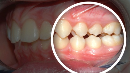 Product image for  Class II Correction 2024