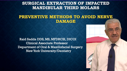 Product image for Surgical Extraction Of Impacted Mandibular Third Molars