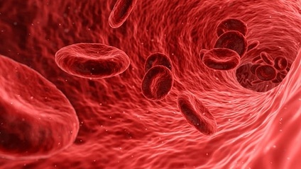 Product image for How to Identify Complete Blood Count Patterns and Manage them Clinically