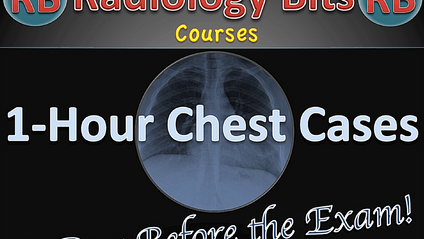 Product image for One-Hour Chest Cases: Take it Like a real Exam