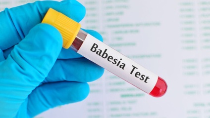 Product image for An Introduction to Human Babesiosis
