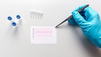 Product image for Diagnostic Challenges in Lyme disease