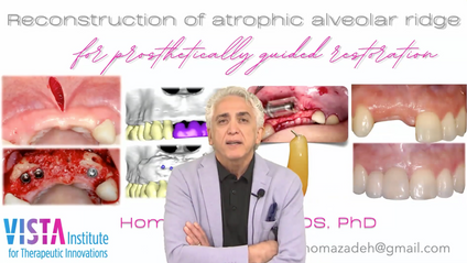 Product image for Improving the Predictibility of Alveolar Ridge Augmentation