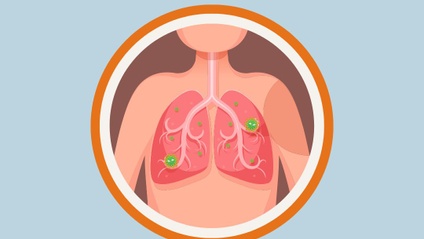 Product image for MS Nursing – Respiratory
