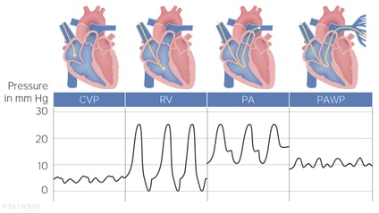Product image for Excellence in Hemodynamic Monitoring