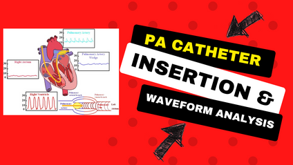 Product image for Pulmonary Artery Catheter Insertion & Waveform Analysis (4 CE Hours)
