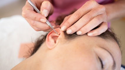 Product image for Advanced Auricular Therapy
