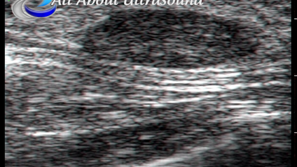 Product image for Breast Ultrasound - Test & Learn Registry Review Quiz