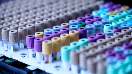 Product image for  Blood Sugar Patterns: How to Identify and Manage them Clinically