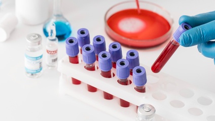 Product image for Control de la calidad en componentes sanguíneos