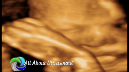 Product image for OB-GYN Ultrasound - Test & Learn Registry Review Quiz