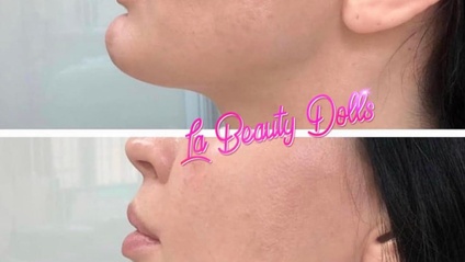 Product image for Jawline & Chin Masterclass