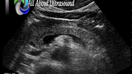 Product image for Abdomen Ultrasound - Test & Learn Registry Review Quiz
