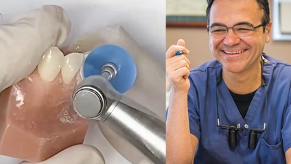 Product image for Become a Cosmetic Dentist with Composite Resin Veneers