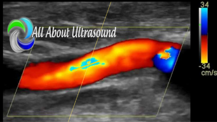 Product image for Vascular Ultrasound - Test & Learn Registry Review Quiz