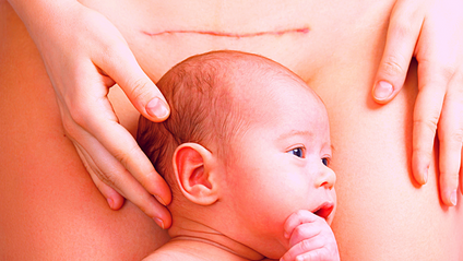 Product image for C-SECTION HEALING MEDITATION