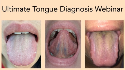 Product image for Ultimate Tongue Diagnosis Webinar with Clinical Applications