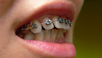 Product image for Class II Correction 2022