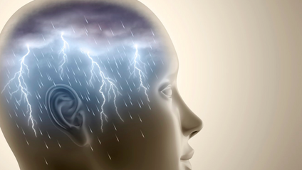 Product image for Migraine