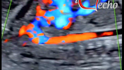 Product image for Fetal Echocardiography - Test & Learn Registry Review Quiz