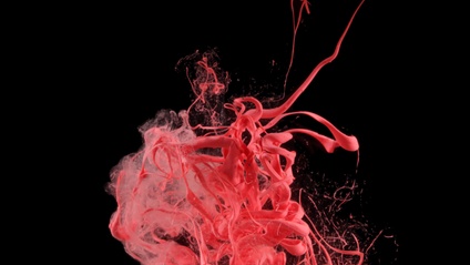 Product image for Peripheral Vascular Disease