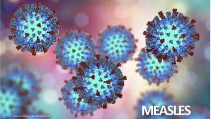 Product image for Measles 2025