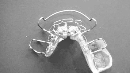 Product image for Epigenetic Orthodontics: Face and airway development