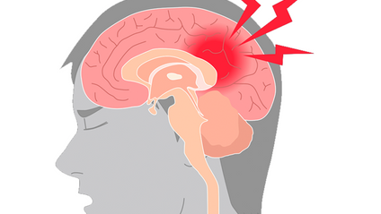 Product image for Traumatic Brain Injury C1026 | 2 Hrs