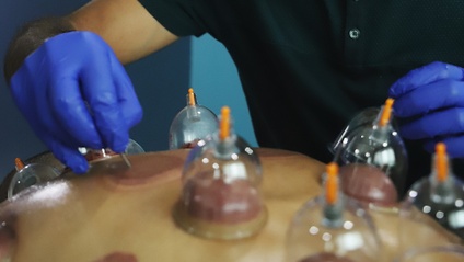 Product image for STAGE 2 | Advanced Wet-Cupping Therapy  | ICAHT Hijama Diploma