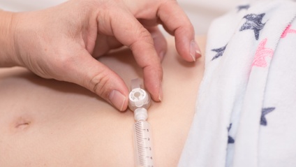 Product image for Care and Maintenance of Gastrostomy Tubes