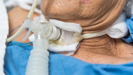 Product image for Tracheostomy Care