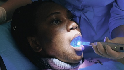 Product image for Incorporating Laser Dentistry Into Your Practice