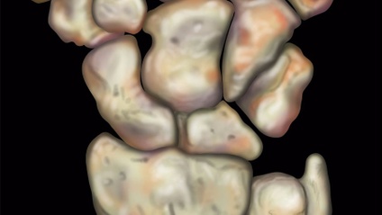 Product image for MRI Mastery Series: Wrist
