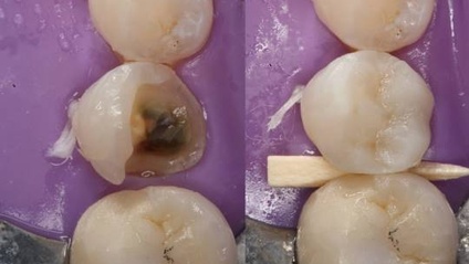 Product image for Direct Posterior Composites: Efficiency and Esthetics