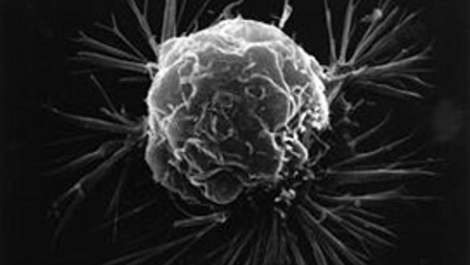 Product image for Aggressive Hallmarks of Cancer