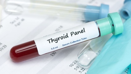 Product image for YHR Thyroid Panel