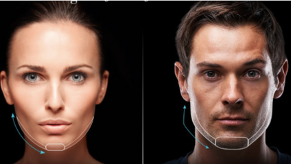 Product image for Jawline & Chin Enhancement