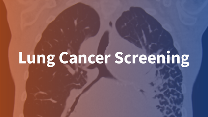 Product image for Lung Cancer Screening