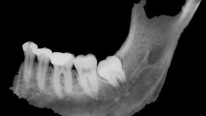 Product image for Dental Anatomy
