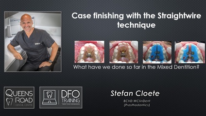 Product image for Course 4 : Finishing Cases with the Straightwire Technique