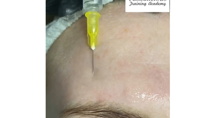 Product image for Mesotherapy