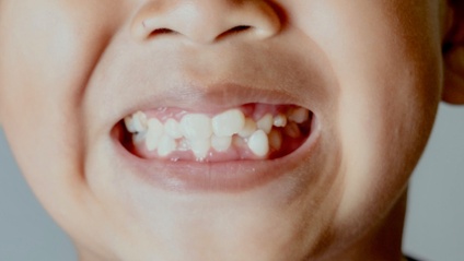 Product image for How CBCT Is Changing The Way We Move Teeth