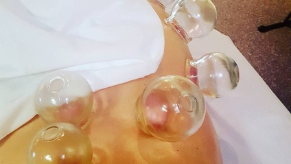 Product image for Therapeutic Cupping Low back and Pelvis - Online