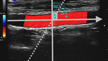 Product image for Ultrasound Physics SPI - Registry Review Course
