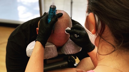 Product image for Fundamental Scalp MicroPigmentation
