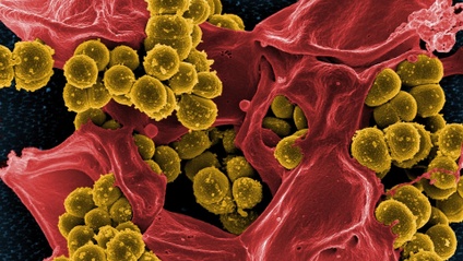 Product image for The Vaginal Microbiome in Health and Disease: Treating Vaginal dysbiosis, Bacterial Vaginosis and Group B Streptococcus.