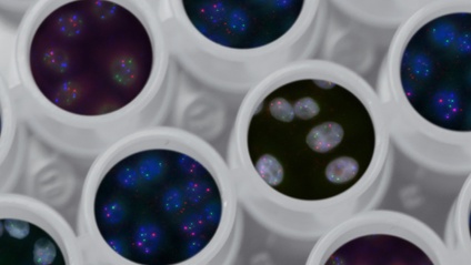 Product image for Advanced Nutrigenomic Training: DNA Protection, Damage and Repair
