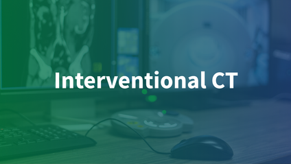 Product image for Interventional CT