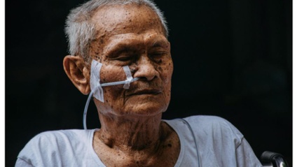 Product image for Nasogastric Tube Insertion, Care and Maintenance