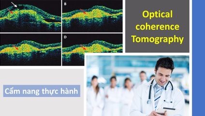Product image for Hướng dẫn đọc OCT từ A đến Z